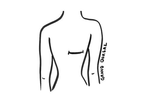 grand dorsal sans prothese pour la reconstruction du sein post mastectomie